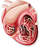 Heartworm